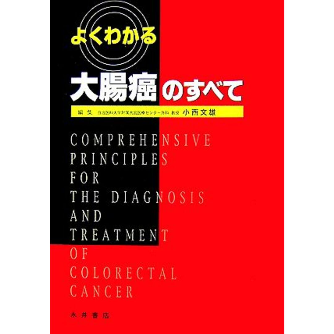 よくわかる大腸癌のすべて／小西文雄【編】 エンタメ/ホビーの本(健康/医学)の商品写真