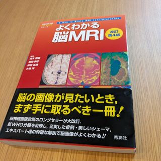 よくわかる脳ＭＲＩ