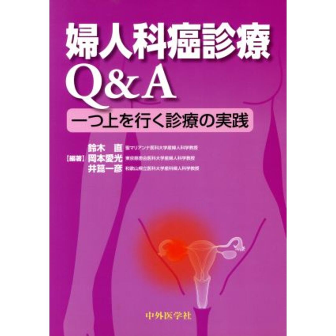 婦人科癌診療Ｑ＆Ａ　一つ上を行く診療の実践／鈴木直,岡本愛光,井箟一彦 エンタメ/ホビーの本(健康/医学)の商品写真