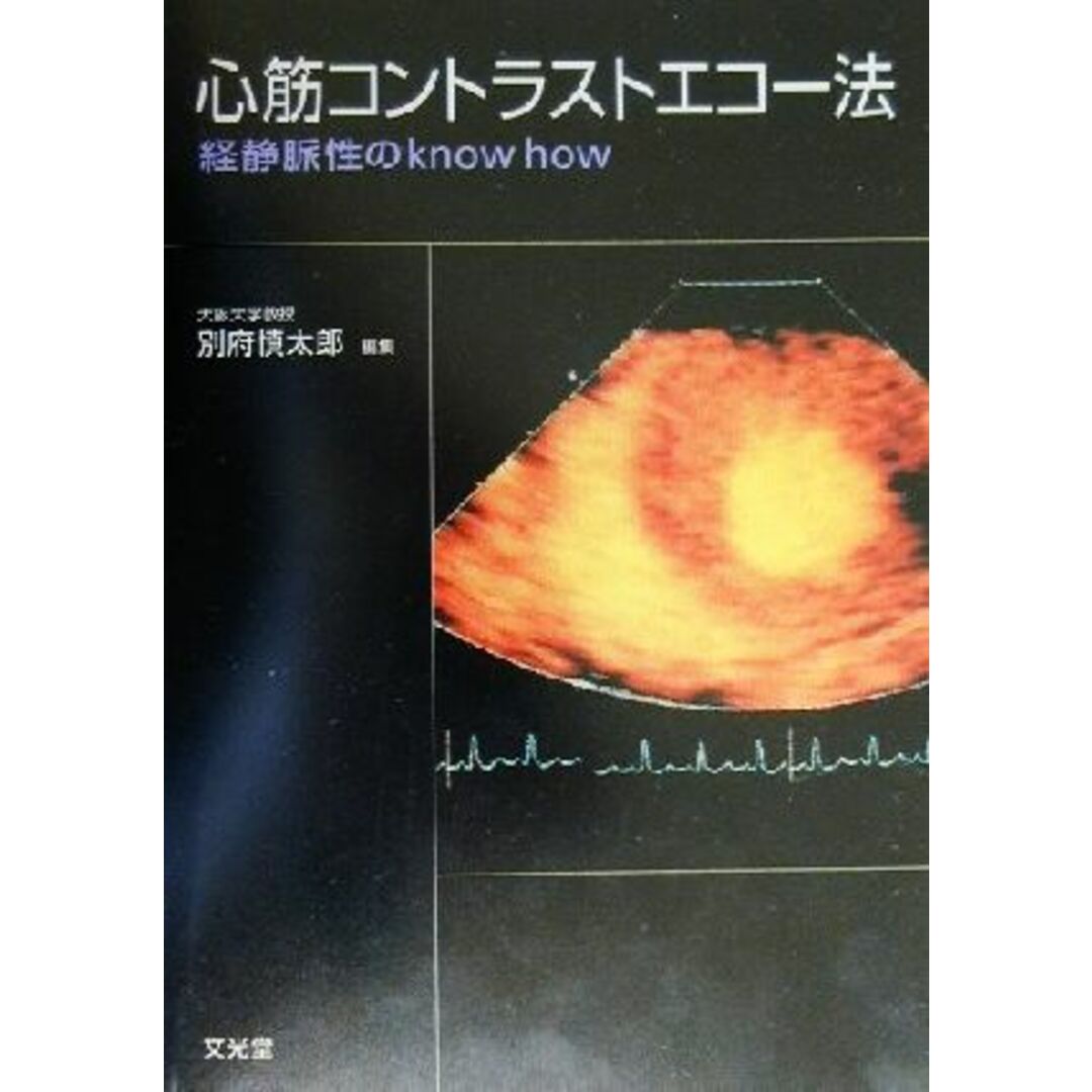 心筋コントラストエコー法 経静脈性のｋｎｏｗ　ｈｏｗ／別府慎太郎(編者) エンタメ/ホビーの本(健康/医学)の商品写真