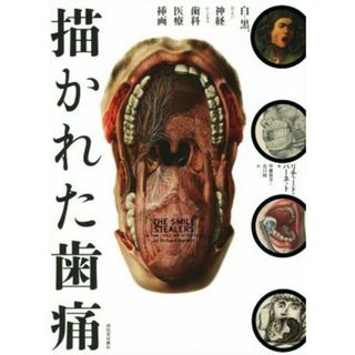 描かれた歯痛 白と黒、および神経からなる歯科医療挿画／リチャード・バーネット(著者),中里京子(訳者),北川玲(訳者)(健康/医学)