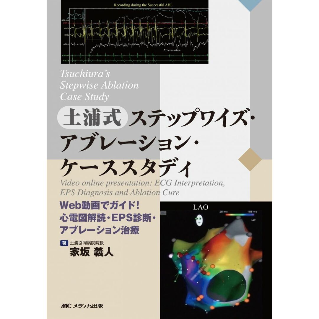 Tsuchiura's Stepwise Ablation Case Study 土浦式ステップワイズ・アブレーション・ケーススタディ: Video online presentation: ECG Interpretation EPS Diagnosis and Ablation Cure Web動画でガイド! 心電図解読・EPS診断・アブレーション治療 エンタメ/ホビーの本(語学/参考書)の商品写真