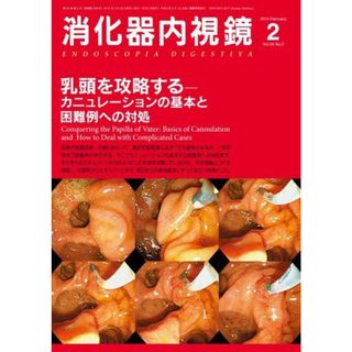 消化器内視鏡第26巻2号 乳頭を攻略する─カニュレーションの基本と困難例への対処 (消化器内視鏡2014年2月号)(語学/参考書)