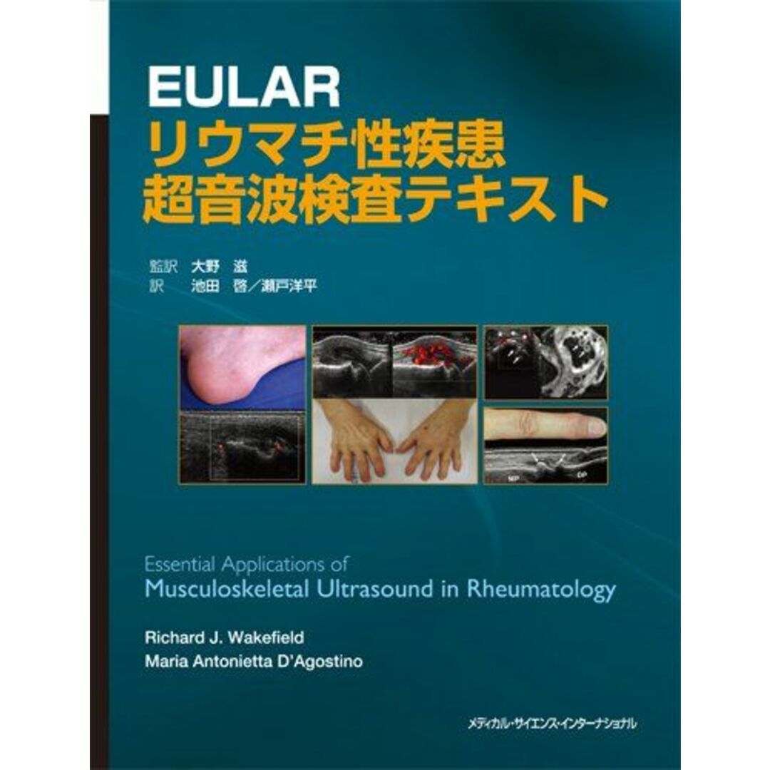 人気大割引 EULAR リウマチ性疾患超音波検査テキスト 大野 滋、 池田 啓 医学一般