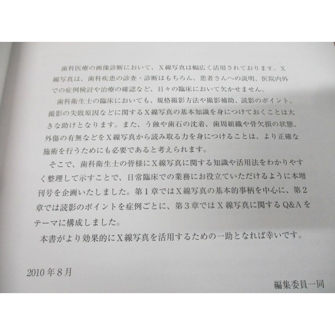 ●01)【同梱不可】歯科衛生士のX線読影力!!/臨床で120%活用するために/DHstyle増刊号/デンタルダイヤモンド社/2010年発行/A エンタメ/ホビーの本(健康/医学)の商品写真