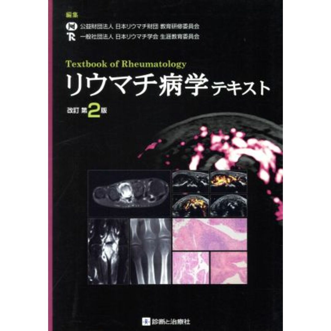 リウマチ病学テキスト　改訂第２版／公益財団法人日本リウマチ財団教育研修委員会(編者),一般社団法人日本リウマチ学会生涯教育委員会(編者) エンタメ/ホビーの本(健康/医学)の商品写真