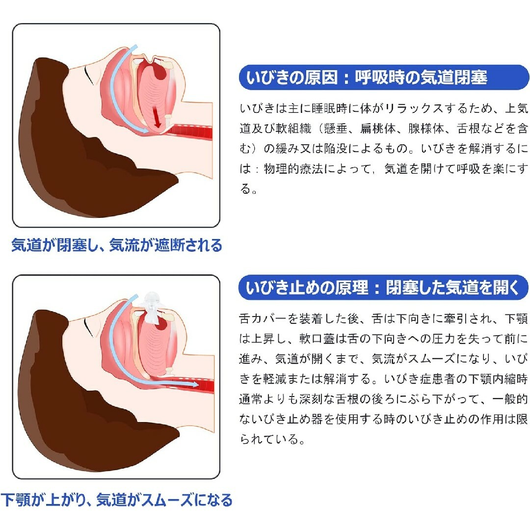 いびき防止グッズ 小型 軽量 安眠グッズ 無呼吸症候群グッズ 洗える リユース インテリア/住まい/日用品の日用品/生活雑貨/旅行(日用品/生活雑貨)の商品写真