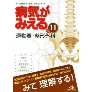 病気がみえる　運動器・整形外科　第１版(ｖｏｌ．１１)／医療情報科学研究所(編者)(健康/医学)