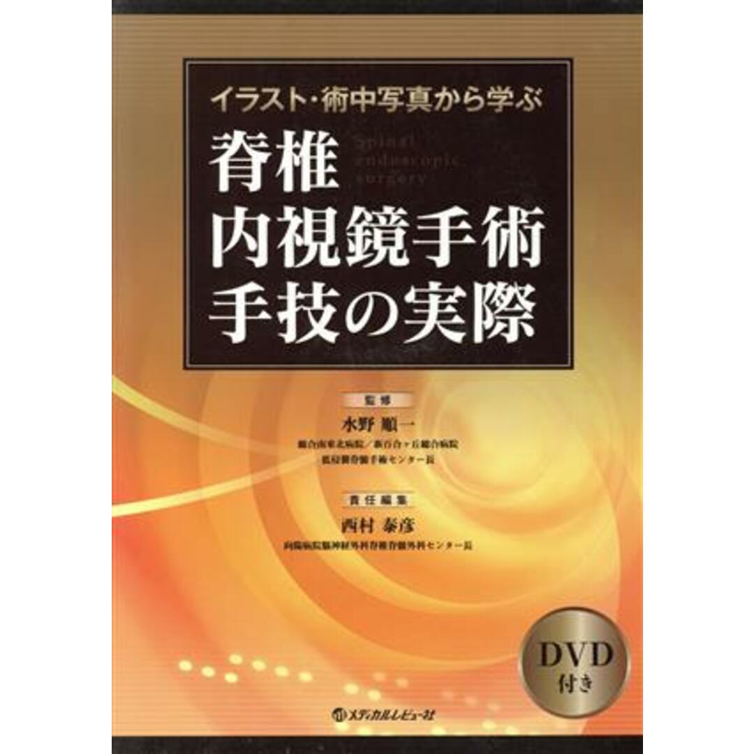 脊椎内視鏡手術手技の実際 イラスト・術中写真から学ぶ／西村泰彦(編者),水野順一 エンタメ/ホビーの本(健康/医学)の商品写真