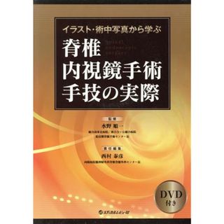 脊椎内視鏡手術手技の実際 イラスト・術中写真から学ぶ／西村泰彦(編者),水野順一(健康/医学)