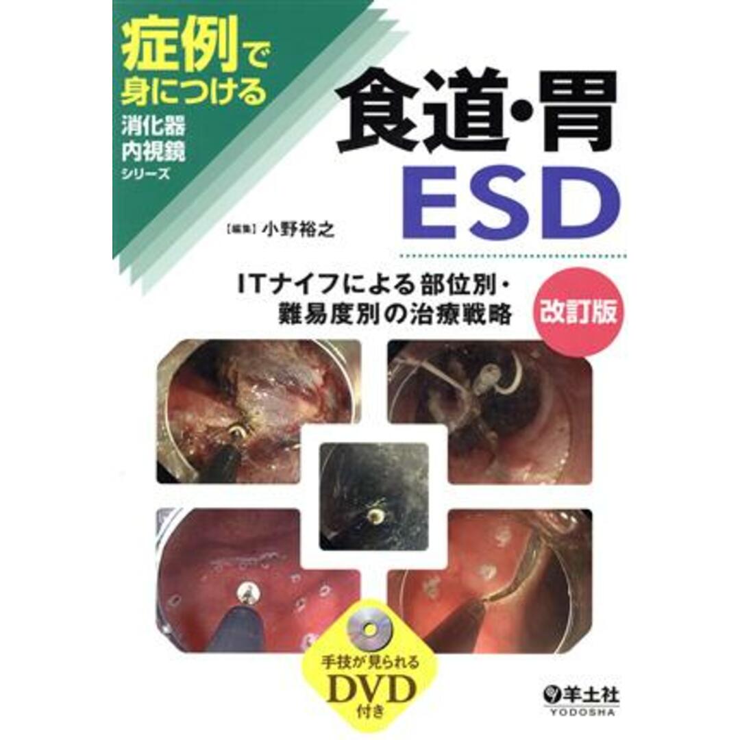 食道・胃ＥＳＤ　改訂版 症例で身につける消化器内視鏡シリーズ／小野裕之(編者) エンタメ/ホビーの本(健康/医学)の商品写真