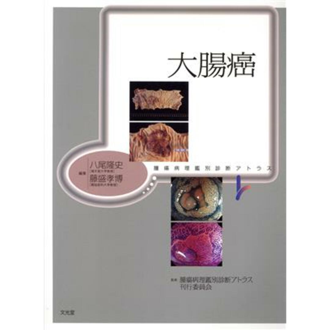 大腸癌／八尾隆史(著者) エンタメ/ホビーの本(健康/医学)の商品写真