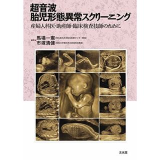 超音波胎児形態異常スクリーニング: 産婦人科医・助産師・臨床検査技師のために [単行本] 一憲，馬場; 清健，市塚(語学/参考書)