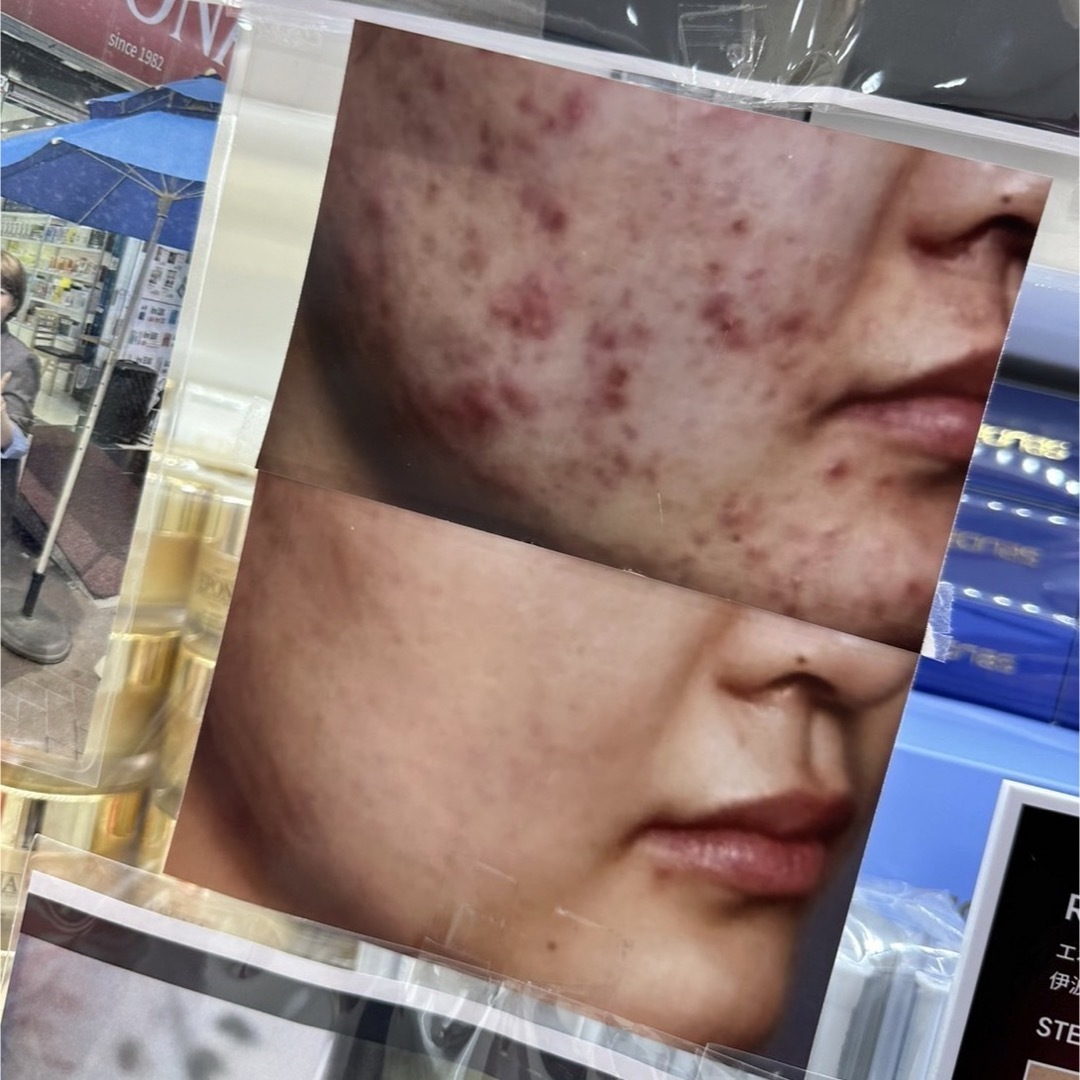rom&nd - Ronas stem cell tox volume fill 幹細胞の通販 by ち rom&nd - Ronas stem cell tox volume fill 幹細胞の通販 by ち