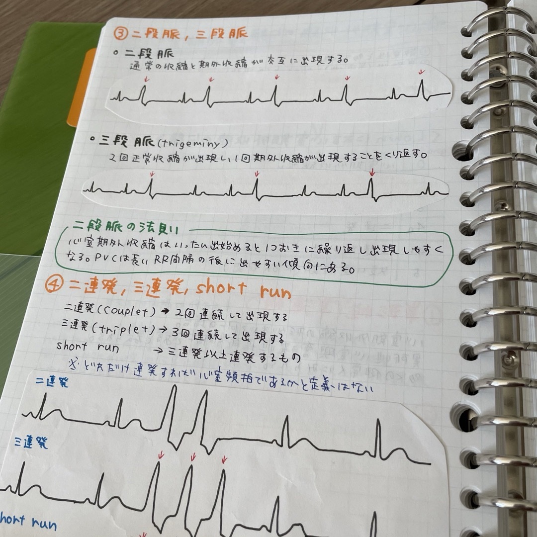 効率良く✨心電図まとめノート エンタメ/ホビーの本(語学/参考書)の商品写真