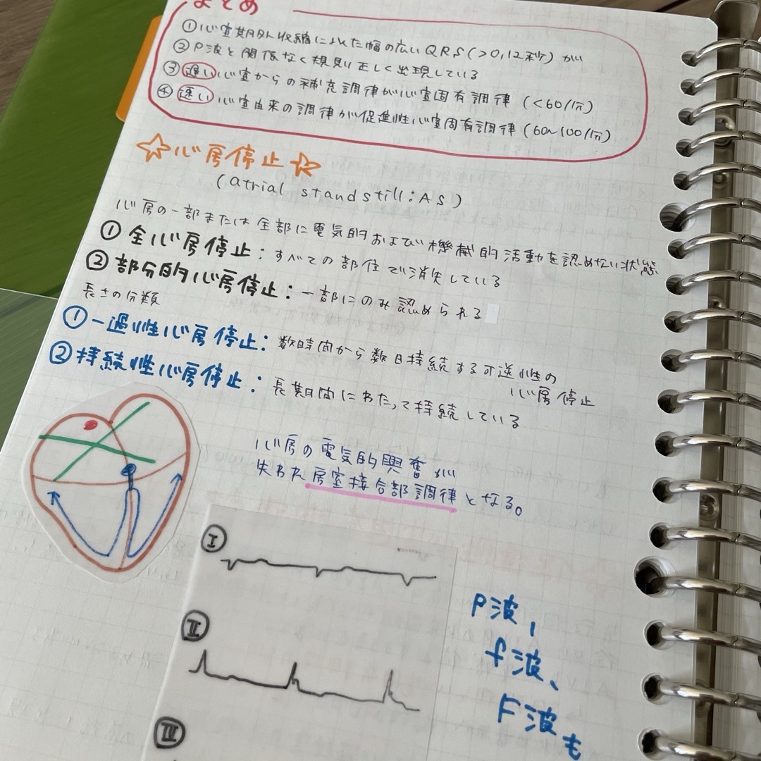 効率良く✨心電図まとめノート エンタメ/ホビーの本(語学/参考書)の商品写真