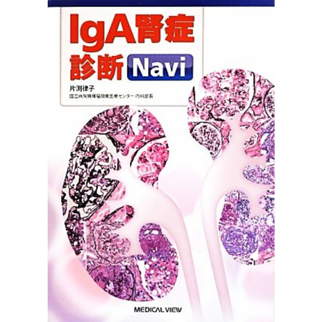 ＩｇＡ腎症診断Ｎａｖｉ／片渕律子(著者) エンタメ/ホビーの本(健康/医学)の商品写真