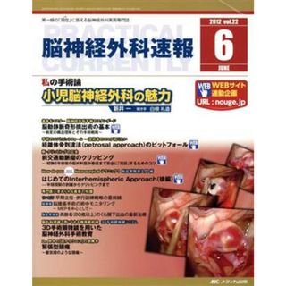 脳神経外科速報(第２２巻６号（２０１２‐６）) 私の手術論　小児脳神経外科の魅力／メディカル(健康/医学)