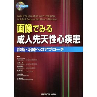 画像でみる成人先天性心疾患　診断・治療へのアプローチ／丹羽公一郎(著者),立野滋(著者)(健康/医学)