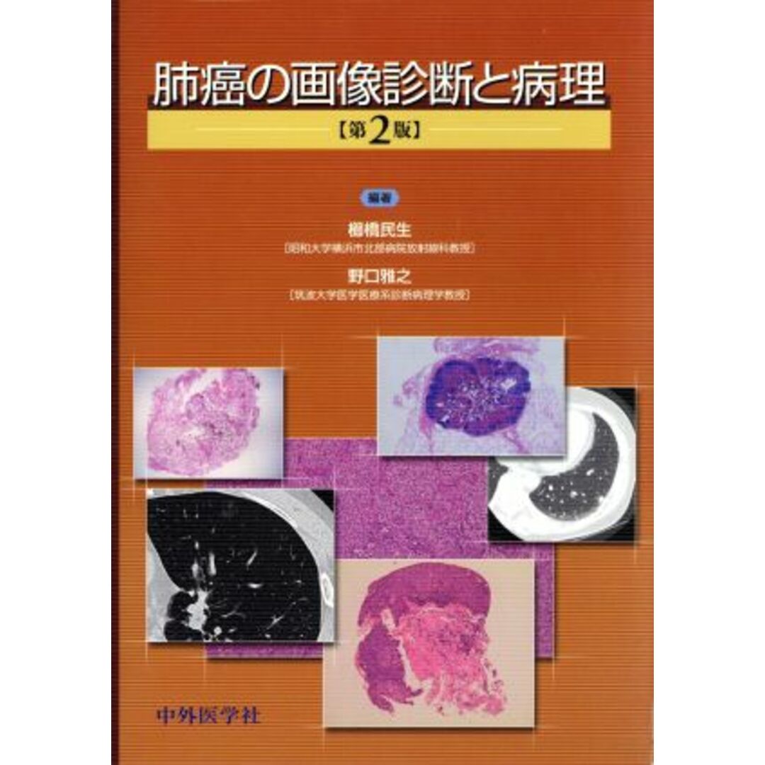 肺癌の画像診断と病理　第２版／櫛橋民生(著者) エンタメ/ホビーの本(健康/医学)の商品写真