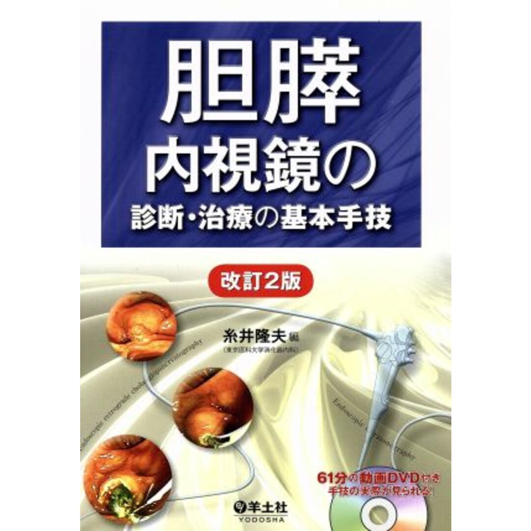 胆膵　内視鏡の診断・治療の基本手技　改訂２版／糸井隆夫(著者) エンタメ/ホビーの本(健康/医学)の商品写真