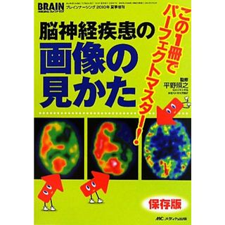 脳神経疾患の画像の見かた この１冊でパーフェクトマスター！／平野照之【監修】(健康/医学)