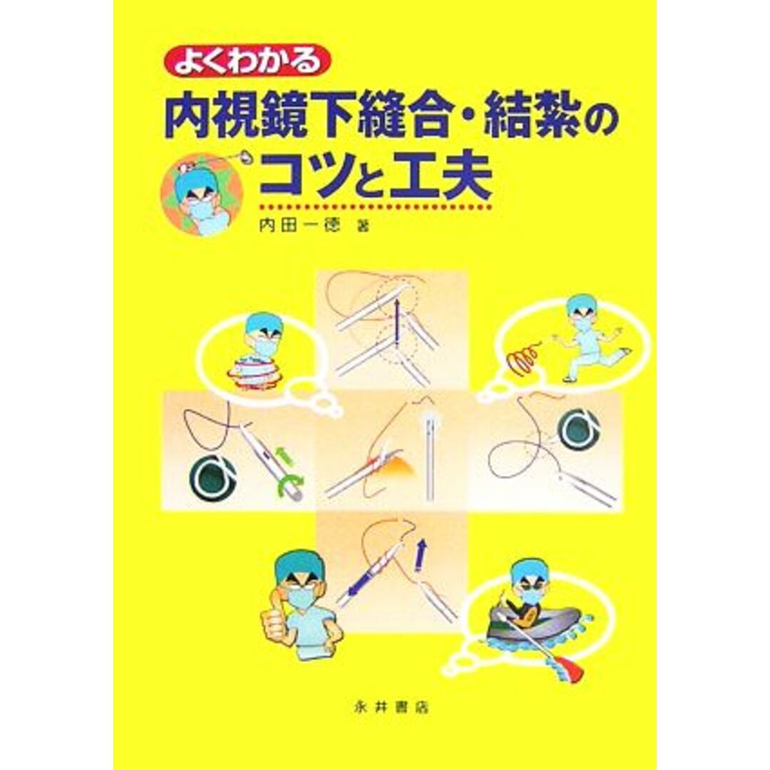 よくわかる内視鏡下縫合・結紮のコツと工夫／内田一徳【著】 エンタメ/ホビーの本(健康/医学)の商品写真