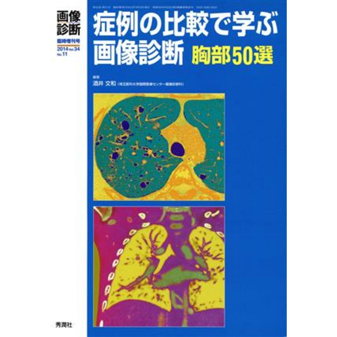 症例の比較で学ぶ画像診断　胸部５０選／酒井文和 エンタメ/ホビーの本(健康/医学)の商品写真