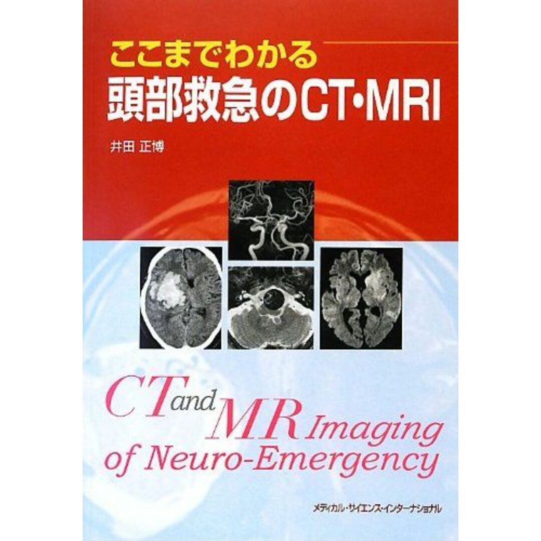 ここまでわかる頭部救急のCT・MRI エンタメ/ホビーの本(語学/参考書)の商品写真