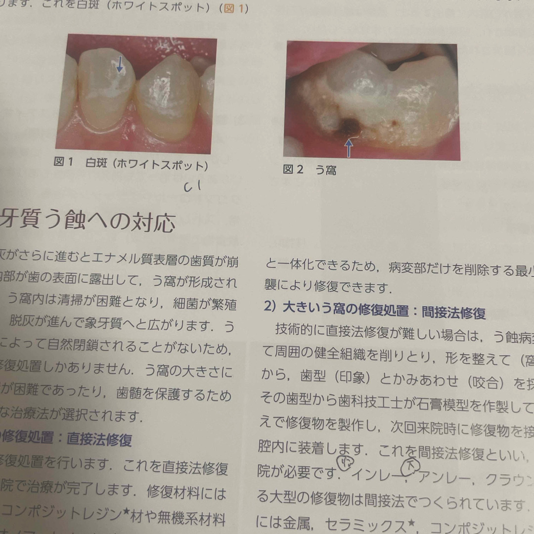 裁断済 歯科衛生士のための歯科臨床概論 エンタメ/ホビーの本(健康/医学)の商品写真