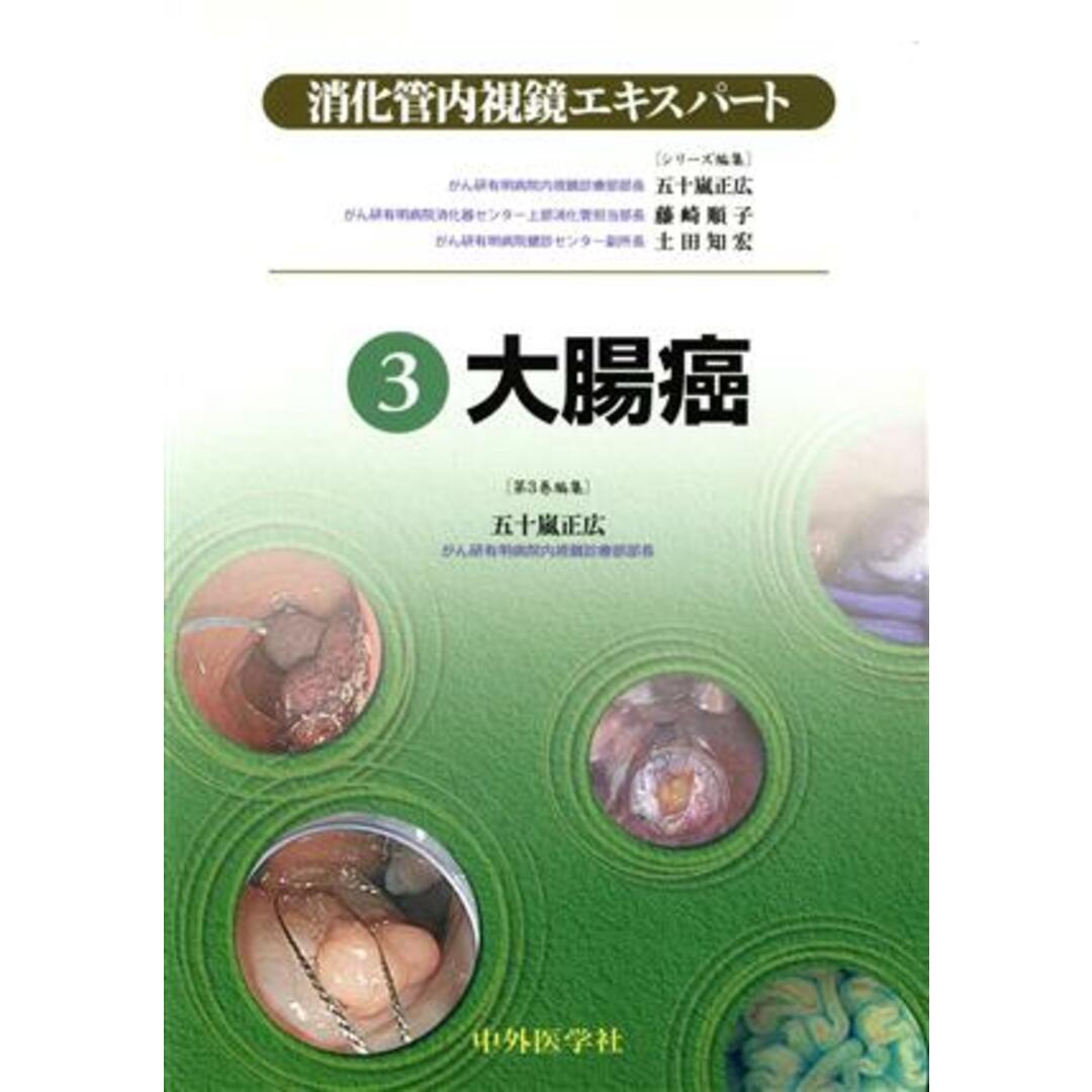 消化管内視鏡エキスパート(３) 大腸癌／五十嵐正広(著者) エンタメ/ホビーの本(健康/医学)の商品写真