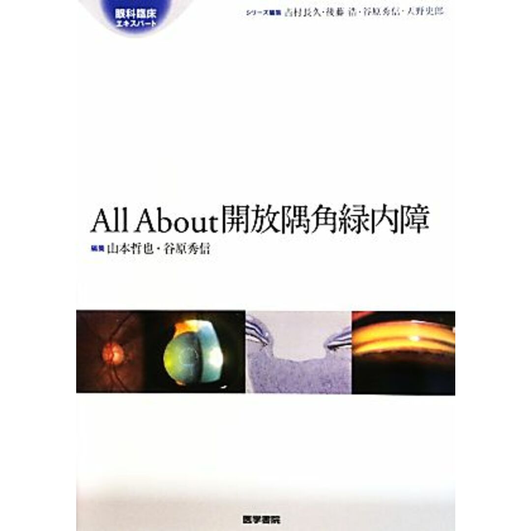 Ａｌｌ　Ａｂｏｕｔ開放隅角緑内障 眼科臨床エキスパート／山本哲也，谷原秀信【編】 エンタメ/ホビーの本(健康/医学)の商品写真