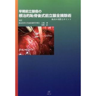 早期前立腺癌の根治的恥骨後式前立腺全摘除術　術式の実際とポイ／大堀理(著者),秦野直(著者)(健康/医学)