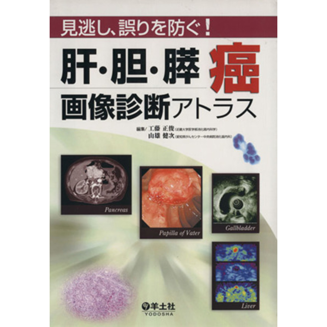 肝・胆・膵癌画像診断アトラス　見逃し、誤りを防ぐ！／工藤正俊(著者),山雄健次(著者) エンタメ/ホビーの本(健康/医学)の商品写真