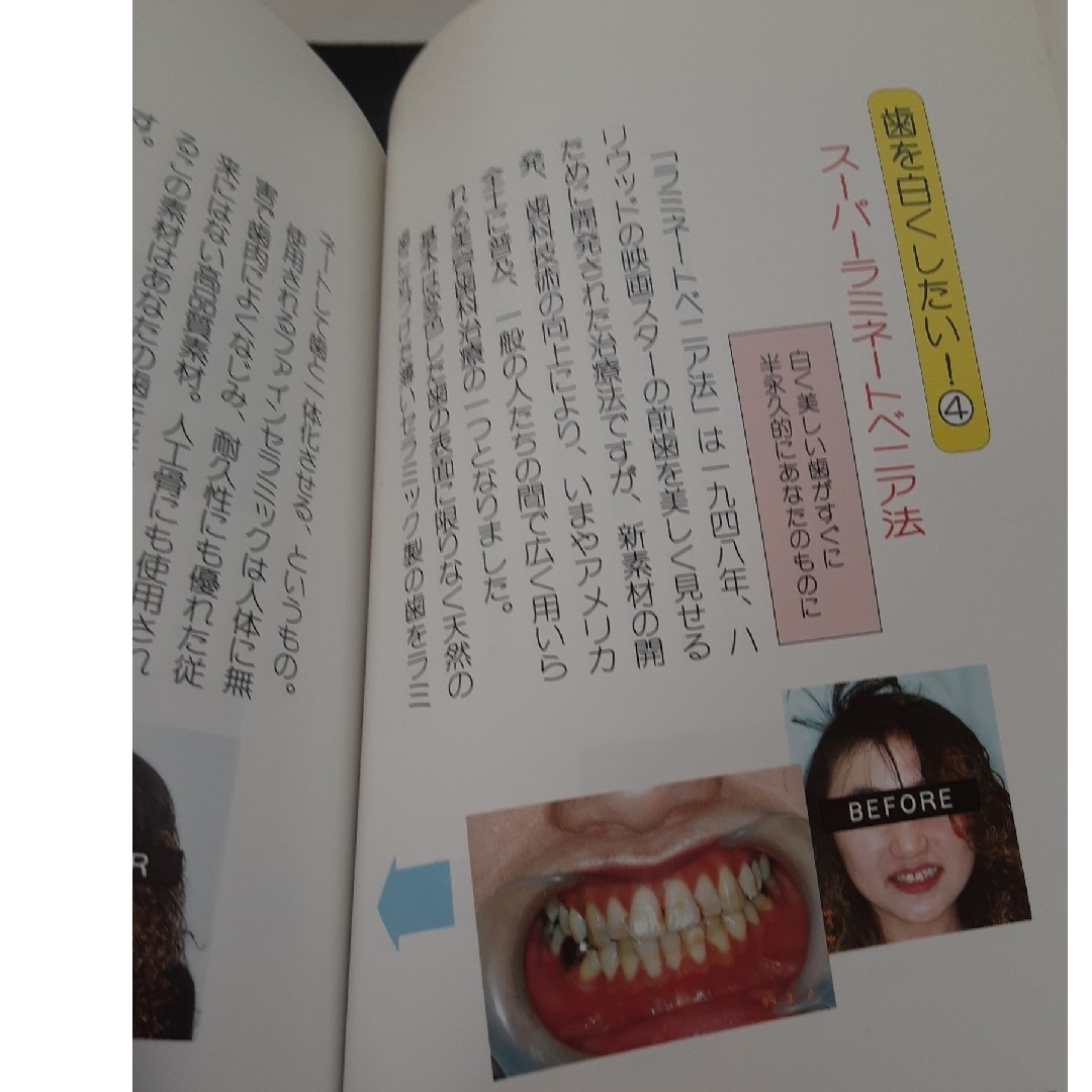 最先端美容歯科を貴方に エンタメ/ホビーの雑誌(生活/健康)の商品写真