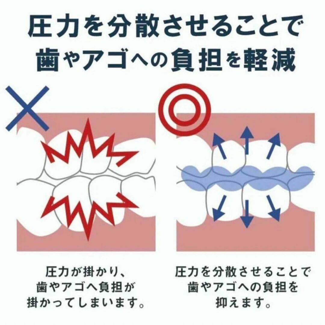 歯ぎしり対策 おとなしくん 男女兼用 繰り返し使用可能 睡眠中の歯を守る 2個 コスメ/美容のオーラルケア(その他)の商品写真