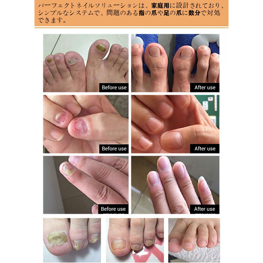 LANBENA ネイルリペアエッセンス　2個セット コスメ/美容のネイル(ネイルケア)の商品写真