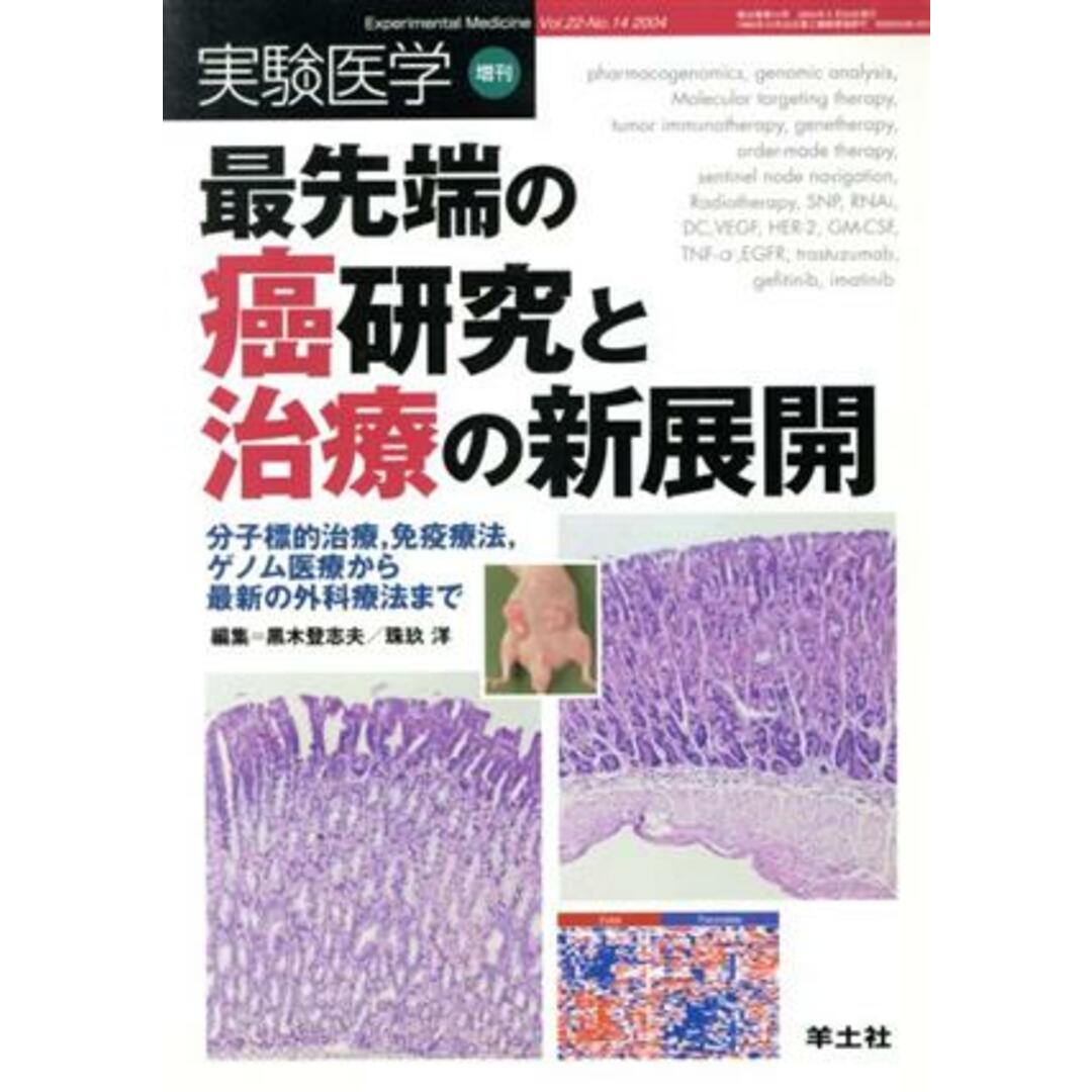 最先端の癌研究と治療の新展開　分子標的治療，免疫療法，ゲノム／黒木登志夫(著者),珠玖洋(著者) エンタメ/ホビーの本(健康/医学)の商品写真