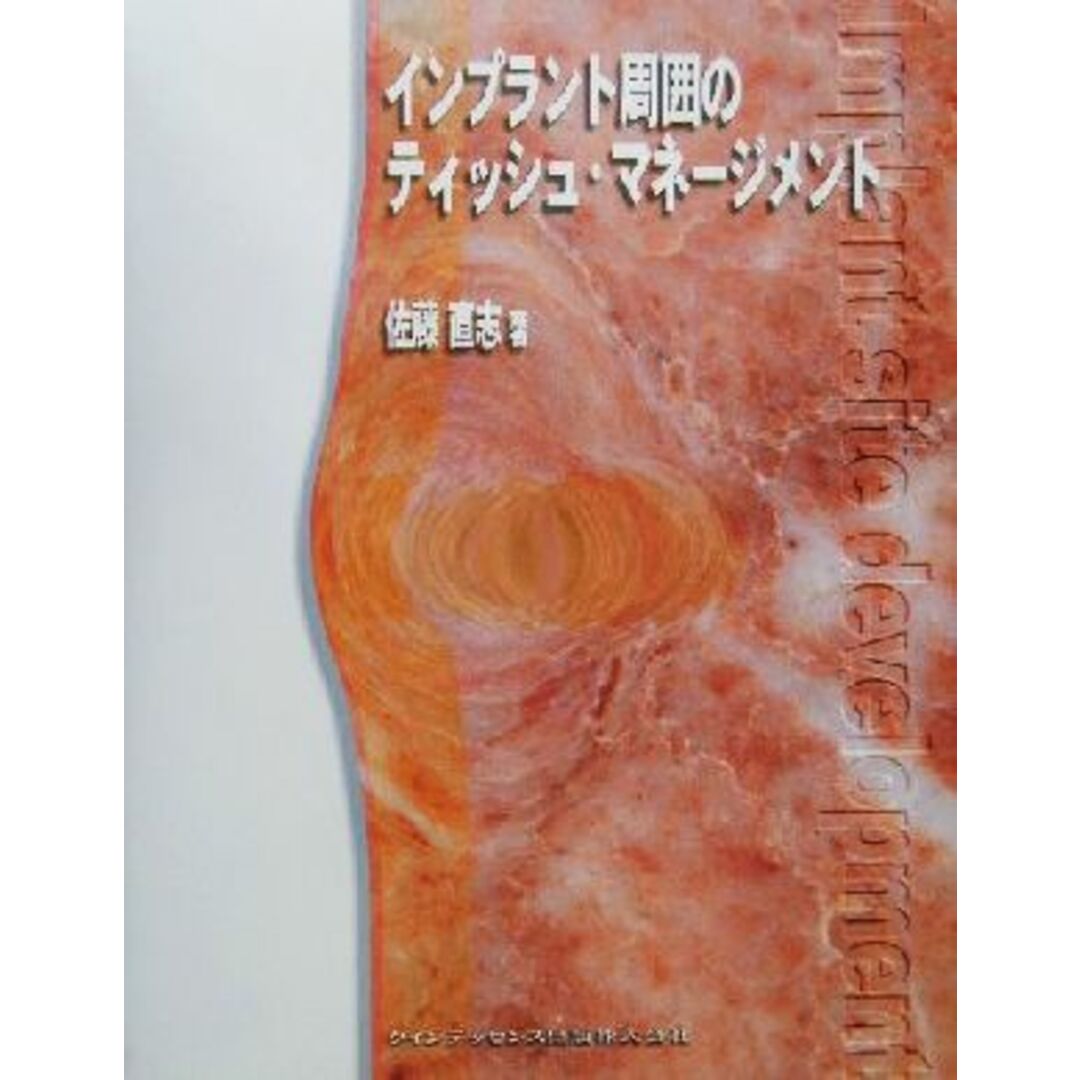 インプラント周囲のティッシュ・マネージメント／佐藤直志(著者) エンタメ/ホビーの本(健康/医学)の商品写真