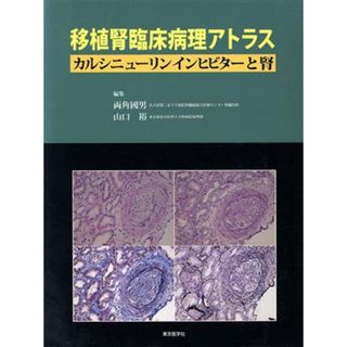 移植腎臨床病理アトラス－カルシニューリン／両角國男(著者),山口裕(著者)(健康/医学)