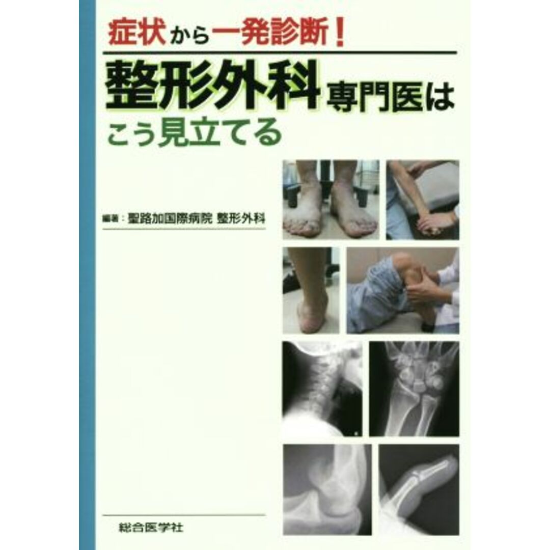 症状から一発診断！整形外科専門医はこう見立てている／聖路加国際病院整形外科 エンタメ/ホビーの本(健康/医学)の商品写真