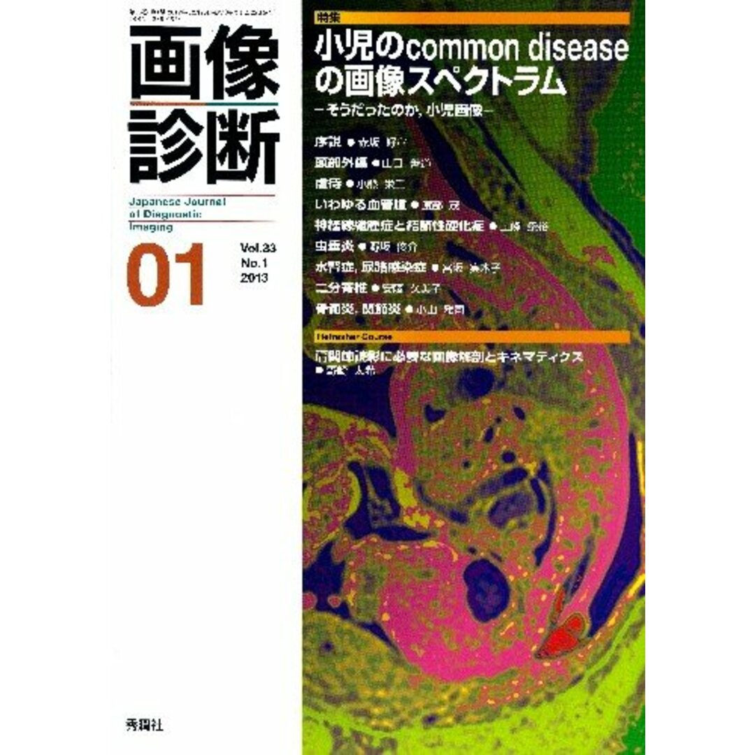 画像診断 13年1月号 (33-1) エンタメ/ホビーの本(健康/医学)の商品写真