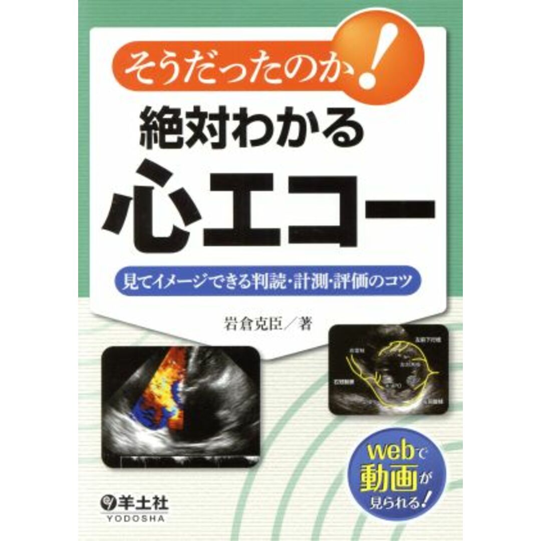 そうだったのか！絶対わかる心エコー 見てイメージできる判読・計測・評価のコツ／岩倉克臣(著者) エンタメ/ホビーの本(健康/医学)の商品写真