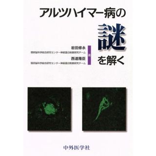 アルツハイマー病の謎を解く／岩田修永(著者)(健康/医学)