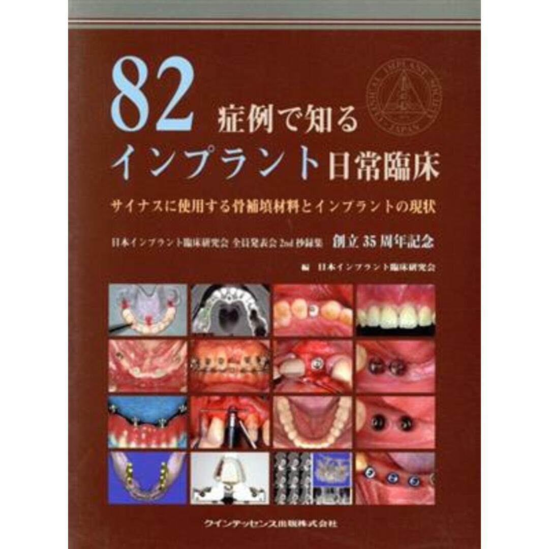 ８２症例で知るインプラント日常臨床／日本インプラント臨床(著者) エンタメ/ホビーの本(健康/医学)の商品写真