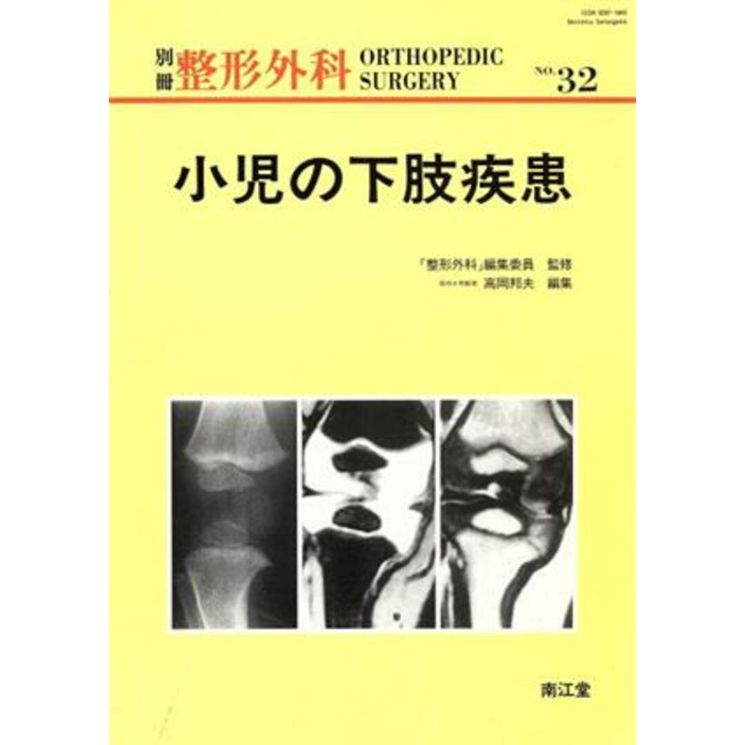 小児の下肢疾患／高岡邦夫(編者),「整形外科」編集委員 エンタメ/ホビーの本(健康/医学)の商品写真