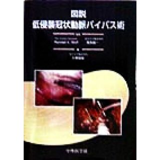 図説　低侵襲冠状動脈バイパス術／大塚俊哉(著者),Ｒａｎｄａｌｌ　Ｋ．Ｗｏｌｆ,高本真一