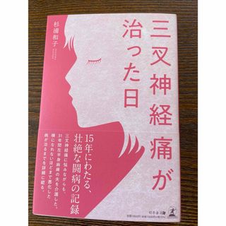 三叉神経痛が治った日