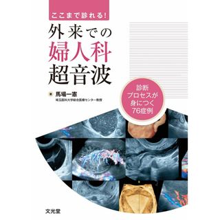 ここまで診れる！外来での婦人科超音波(語学/参考書)