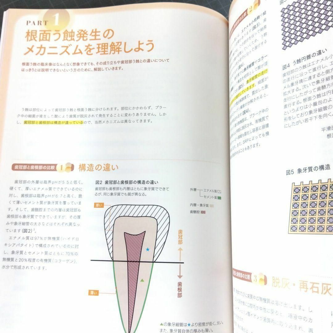 歯科衛生士　2024年4月号　すぐに使える新人教育のくふう　根面う蝕 エンタメ/ホビーの本(健康/医学)の商品写真